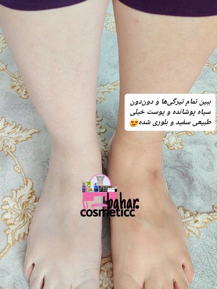 کرم سفیدکننده وکالی - Image 2