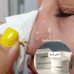 ماسک جوش سرسیاه لانبنا