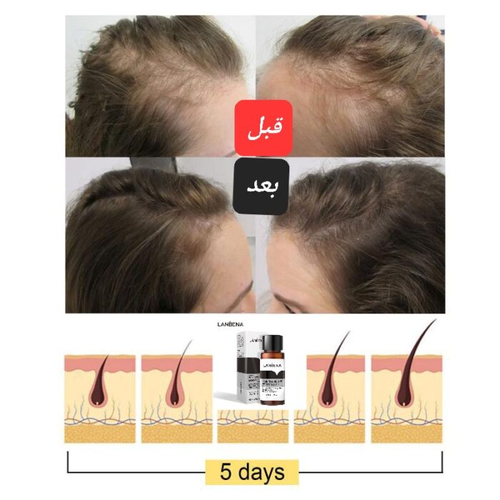 قطره رویش مجدد مو - Image 2