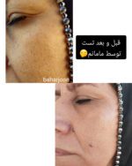 ماسک کلاژن کره‌ای - Image 2