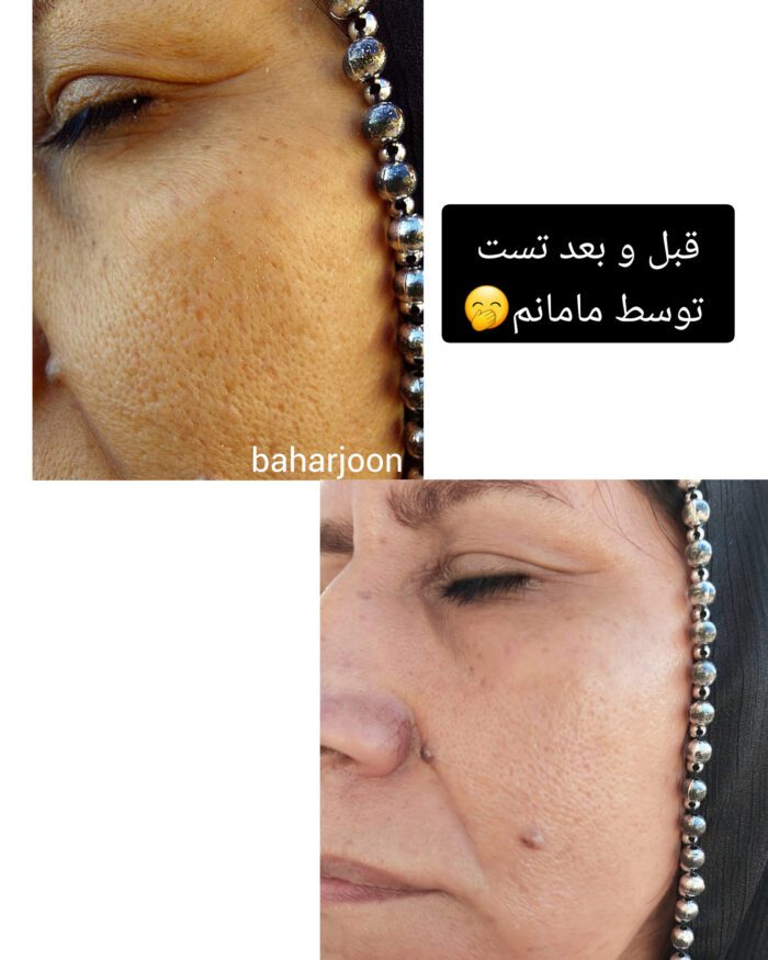 ماسک کلاژن کره‌ای - Image 2