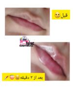 لیپ گلاس حجم دهنده - Image 3