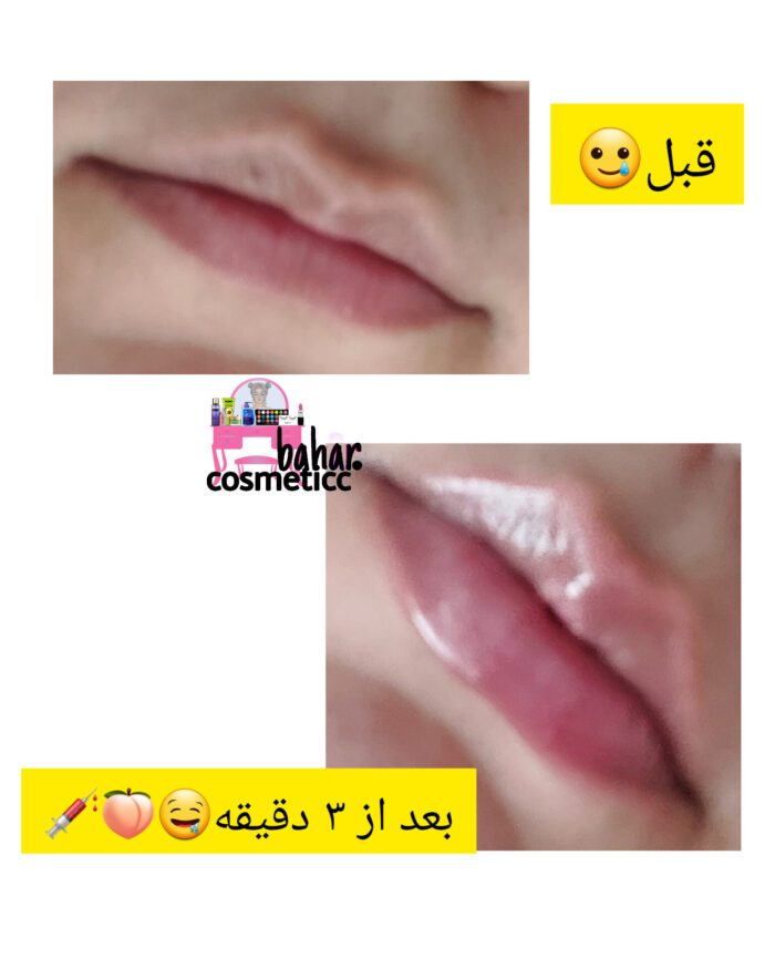 لیپ گلاس حجم دهنده - Image 3