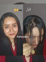 شامپو خشک آلمانی - Image 2